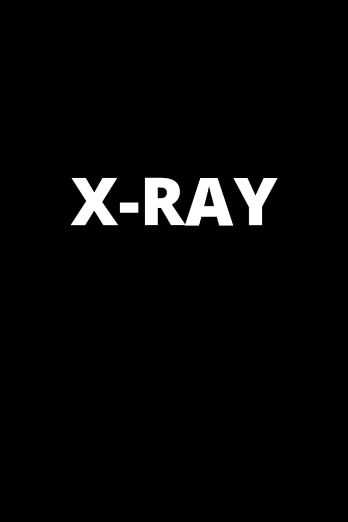 The word x-ray appears in white on a black background